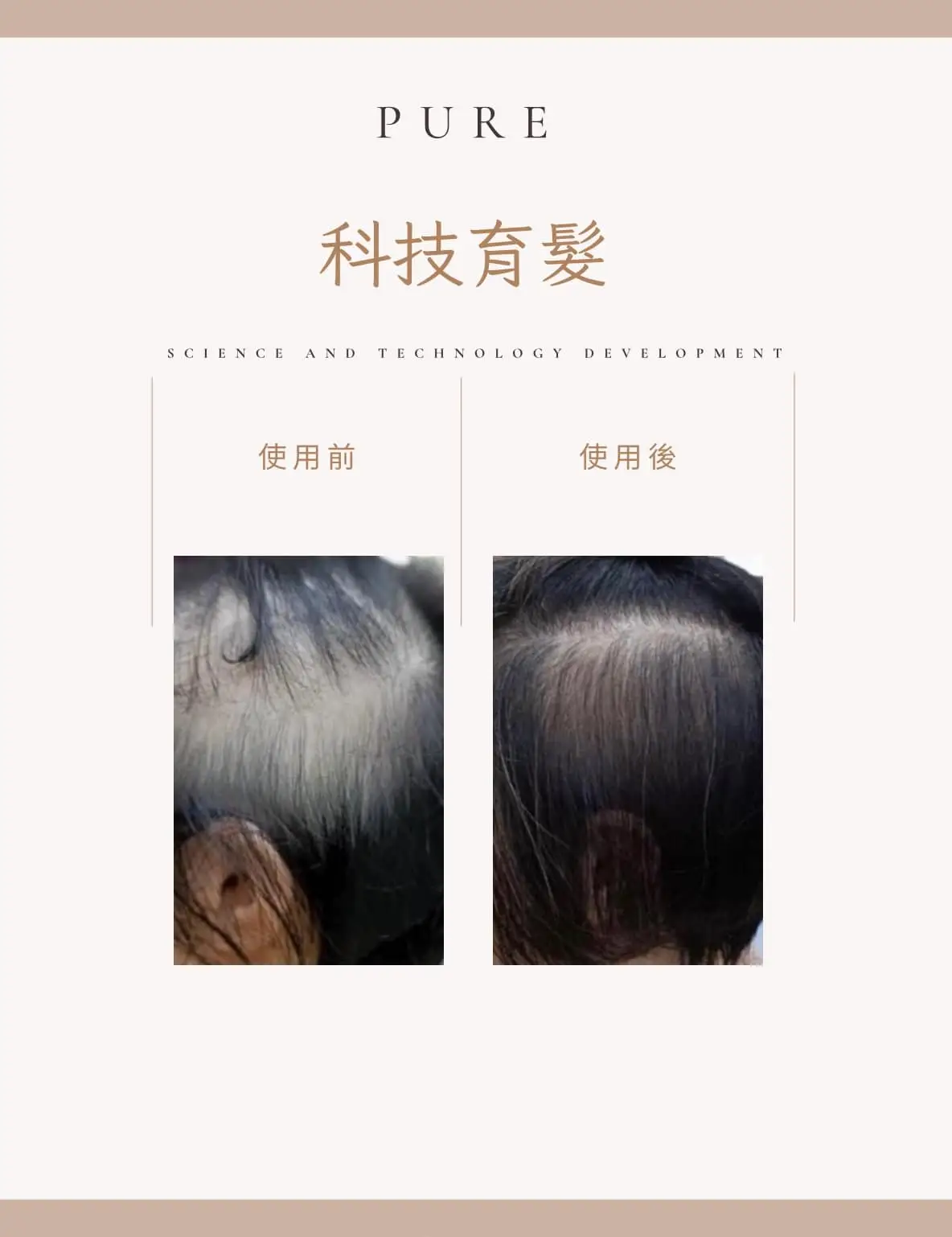 璞·PURE－服務照片2